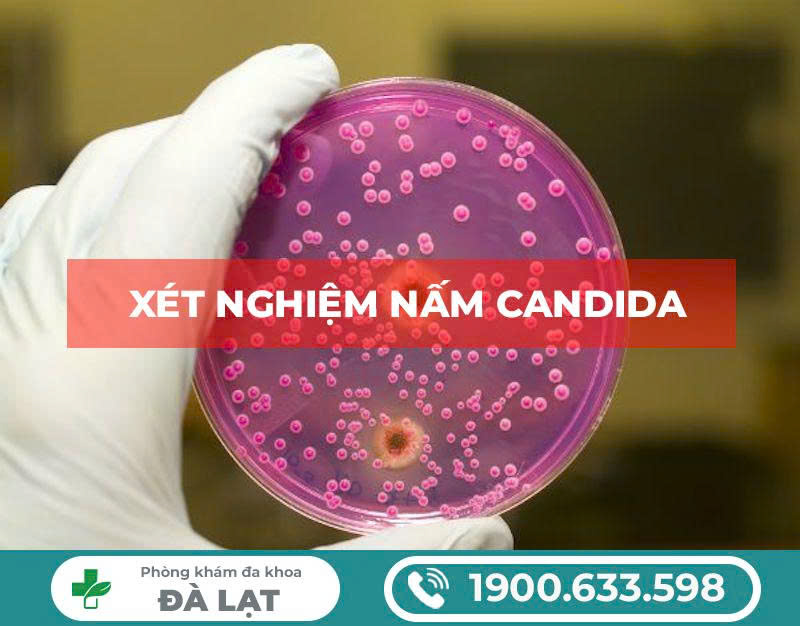 Hình ảnh minh họa